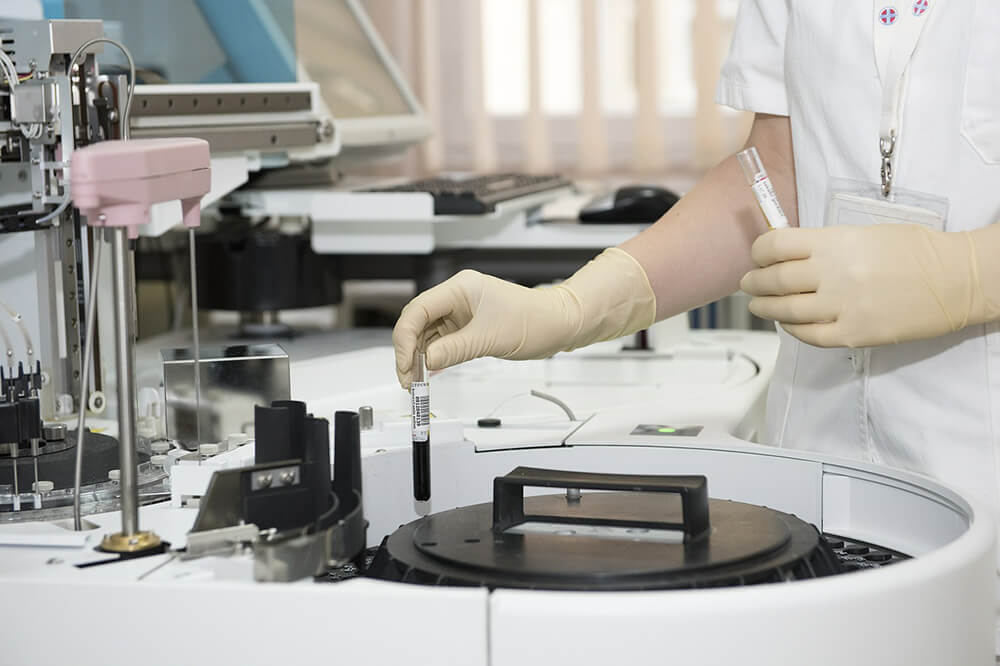 lab technician doing test on blood sample 